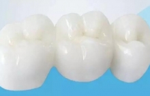 ​氧化锆陶瓷在牙科修复材料领域的应用